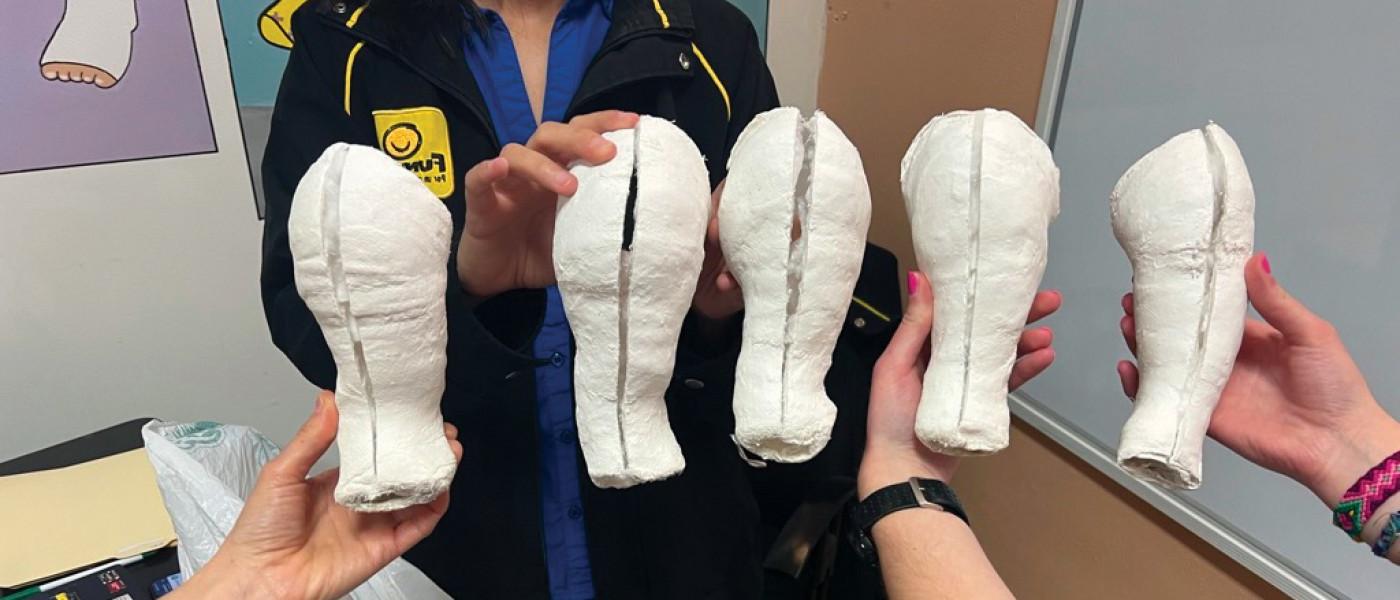 A row of five medical casts